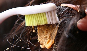 Как убрать жвачку с волос?